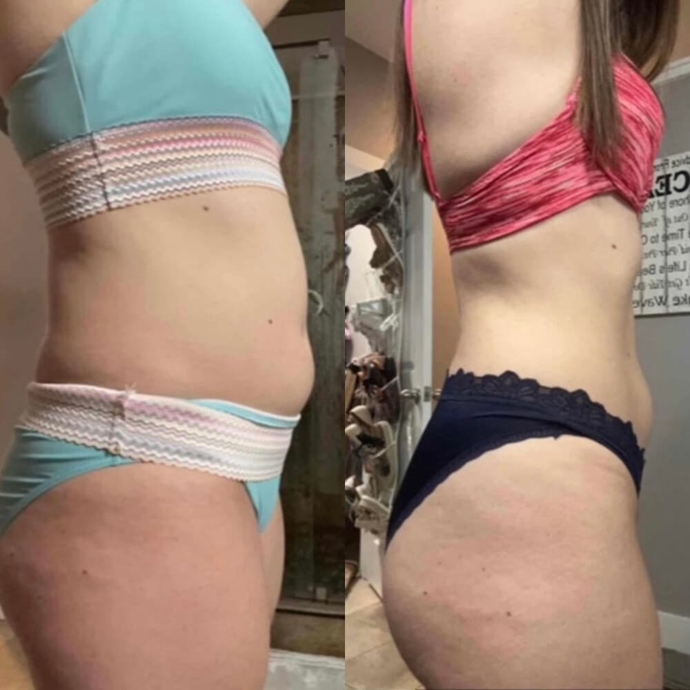 Client before and after, 5 of 6